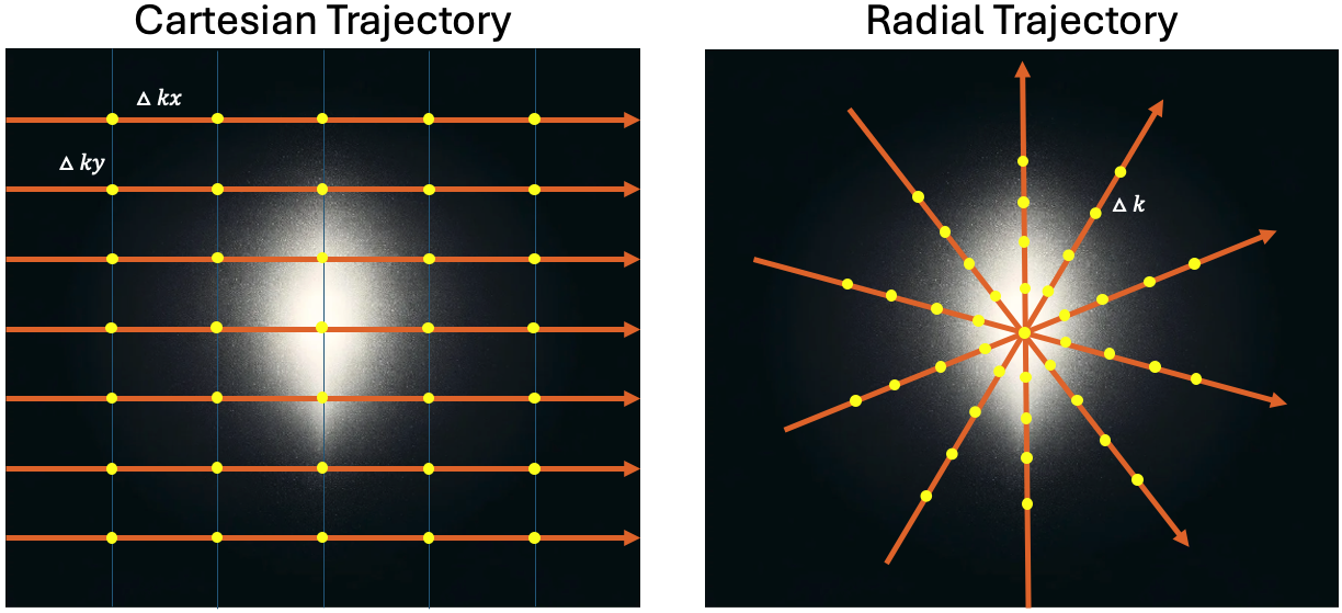 _images/trajectory_ct_radial.png