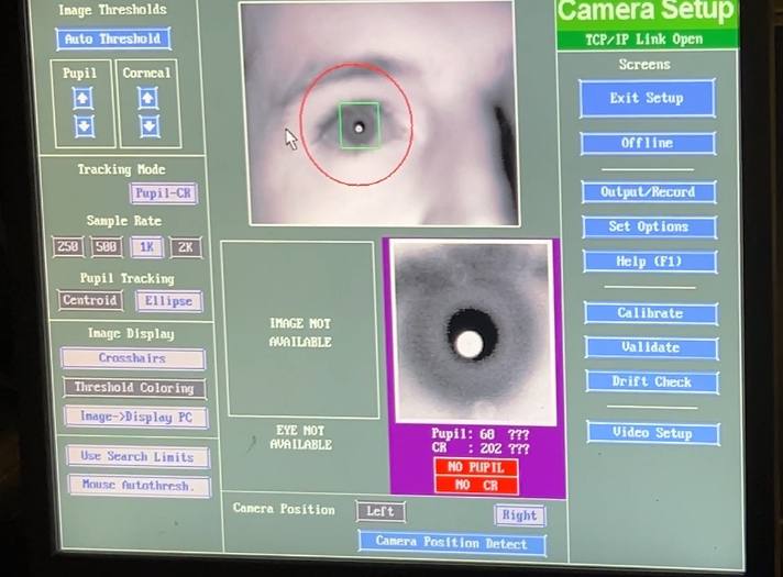 no-pupil