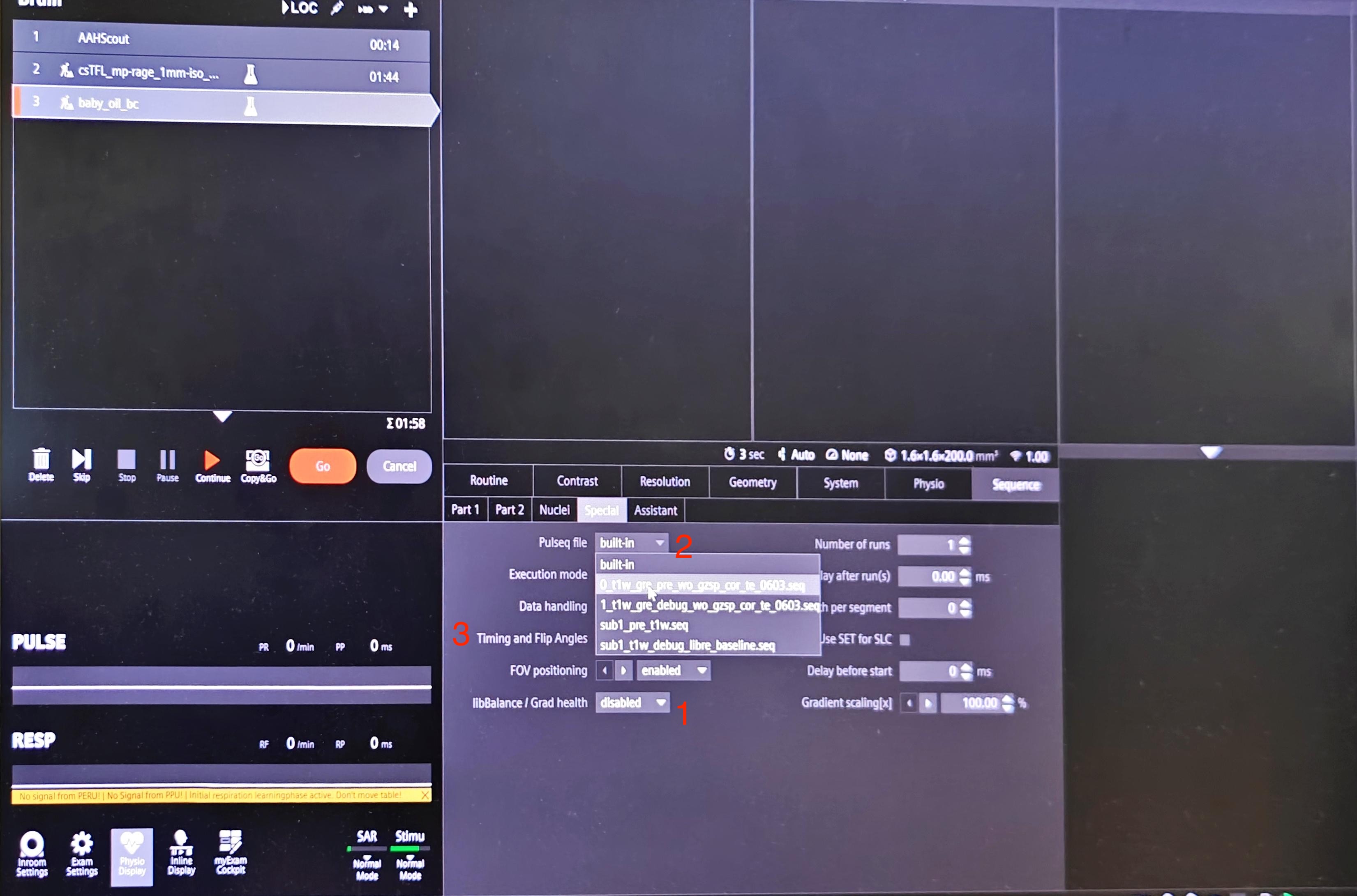 pulseq-load-sequence